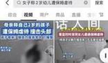 女子稱2歲女兒遭保姆虐待撞擊頭部 力度之大令人震驚