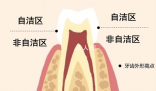 刷牙最該刷的其實不是牙齒 你真的會刷牙嗎？